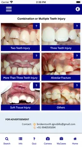 Injured Tooth screenshot 3