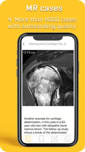 MRI-ESSENTIALS: MSK imaging screenshot 3