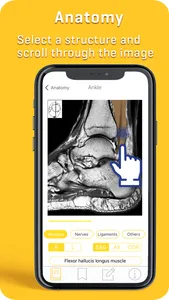 MRI-ESSENTIALS: MSK imaging screenshot 5