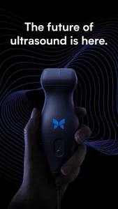 Butterfly iQ — Ultrasound screenshot 0