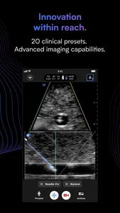 Butterfly iQ — Ultrasound screenshot 1