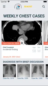 KSTR Weekly Chest Cases screenshot 0