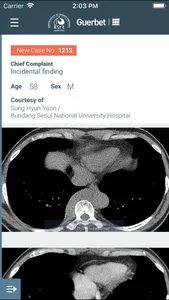 KSTR Weekly Chest Cases screenshot 2