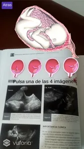 Urgencias en Obstetricia y Medicina Maternofetal screenshot 4