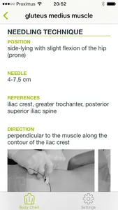 Dry Needling Guide screenshot 1