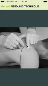 Dry Needling Guide screenshot 3