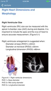 BASIC - Transthoracic Echocard screenshot 1