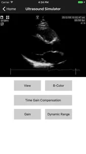 BASIC - Transthoracic Echocard screenshot 2