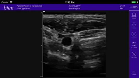 Biim Ultrasound screenshot 2