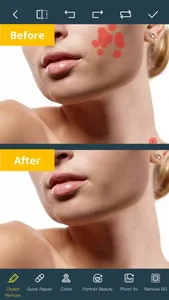 Photo Retouch-Object Removal screenshot 1