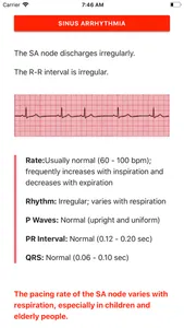 ECG FlashCards screenshot 0
