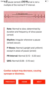 ECG FlashCards screenshot 1