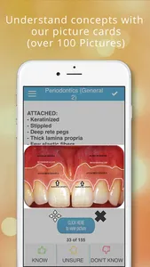 ADAT Periodontics Cram Cards screenshot 1