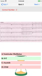 ECG QUIZ START screenshot 2