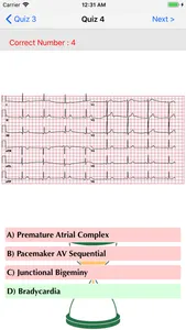 ECG QUIZ START screenshot 3