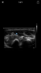 Muscle Ultrasound Course screenshot 3