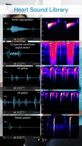 E-Stethoscope & Auscultation screenshot 0