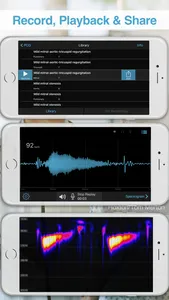 E-Stethoscope & Auscultation screenshot 1