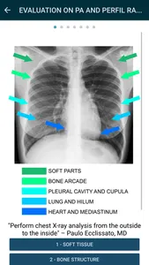 Thorax - thoracic radiology screenshot 3