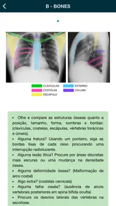 Thorax - thoracic radiology screenshot 5