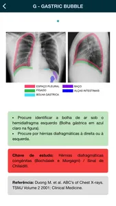 Thorax - thoracic radiology screenshot 6