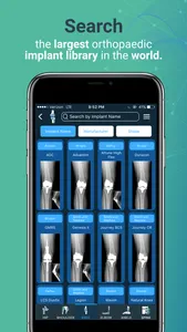 Implant Identifier screenshot 2