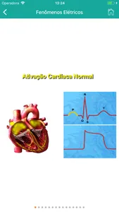 ECG Fácil screenshot 1