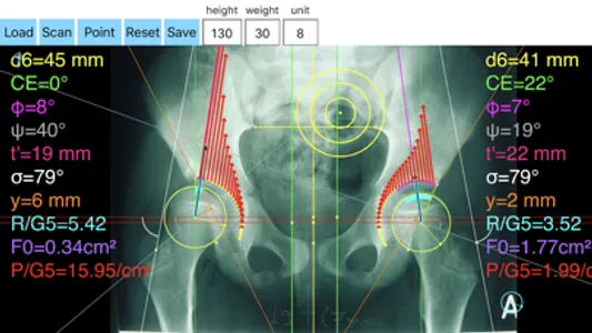 HipBiomechanicsApp screenshot 1