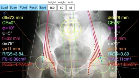 HipBiomechanicsApp screenshot 2