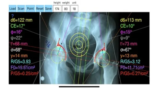 HipBiomechanicsApp screenshot 4
