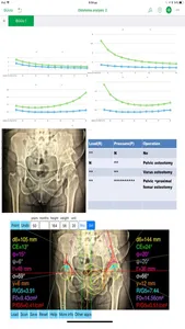 HipBiomechanicsApp screenshot 5