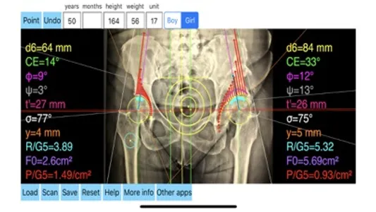 HipBiomechanicsApp screenshot 7