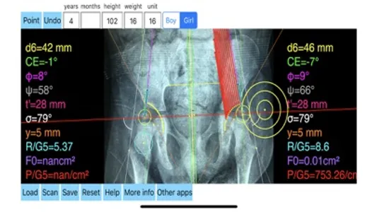 HipBiomechanicsApp screenshot 8