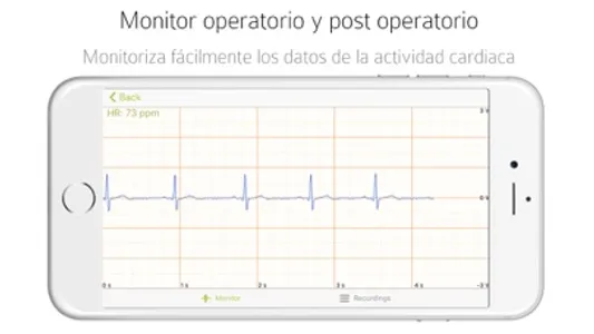 eKuore ECG screenshot 2