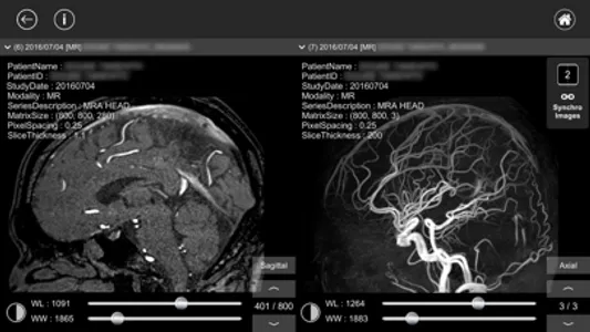 DICOM Viewer : eMma screenshot 3