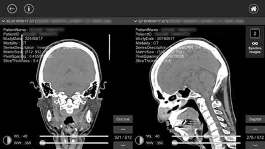 DICOM Viewer : eMma screenshot 4