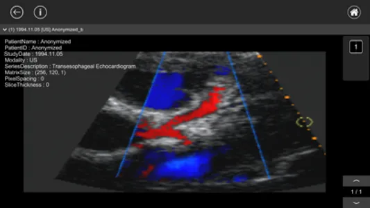 DICOM Viewer : eMma screenshot 5