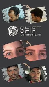 SHIFT Hair Transplant screenshot 0