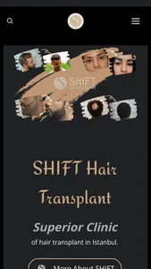 SHIFT Hair Transplant screenshot 1