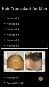 SHIFT Hair Transplant screenshot 2