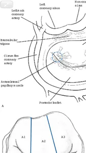 Cardiac Surgery in Adults, 5/E screenshot 7