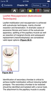 Cardiac Surgery in Adults, 5/E screenshot 9