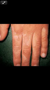 Weinberg's Ped. Dermatology 5E screenshot 7