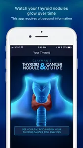 Thyroid Nodule & Cancer Guide screenshot 0