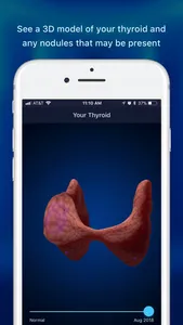 Thyroid Nodule & Cancer Guide screenshot 1