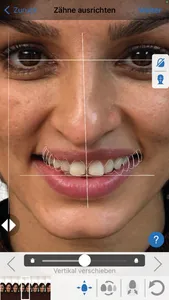 IvoSmile screenshot 1