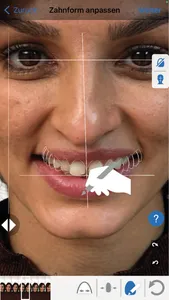 IvoSmile screenshot 2