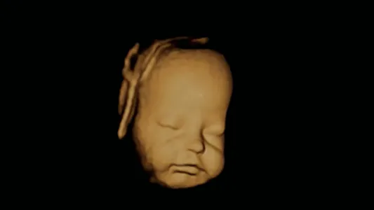 VR Fetus Home Player screenshot 4