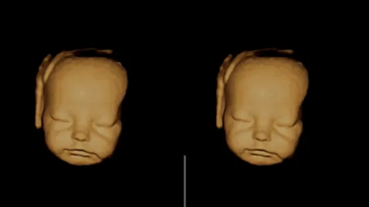 VR Fetus Home Player screenshot 7