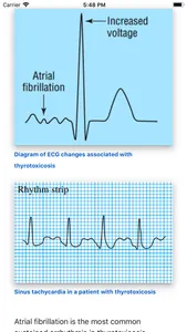 ECG Basics Lite: ECG Made Easy screenshot 1